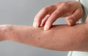 Kenapa Kulit Terasa Gatal di Malam Hari Tapi Tidak Bentol? Ini Penyebabnya